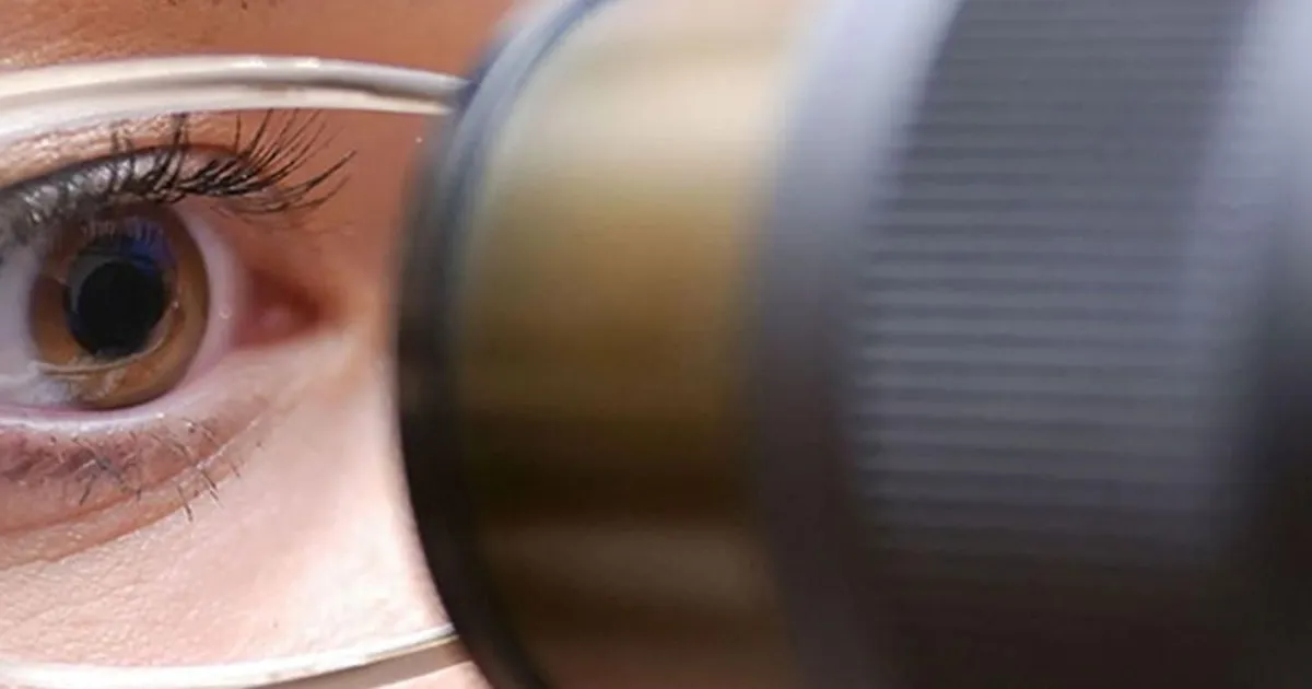 What Are Cataracts?