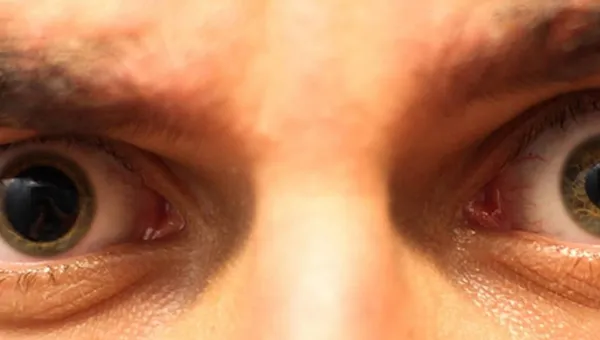 Why Am I Having My Eyes Dilated?