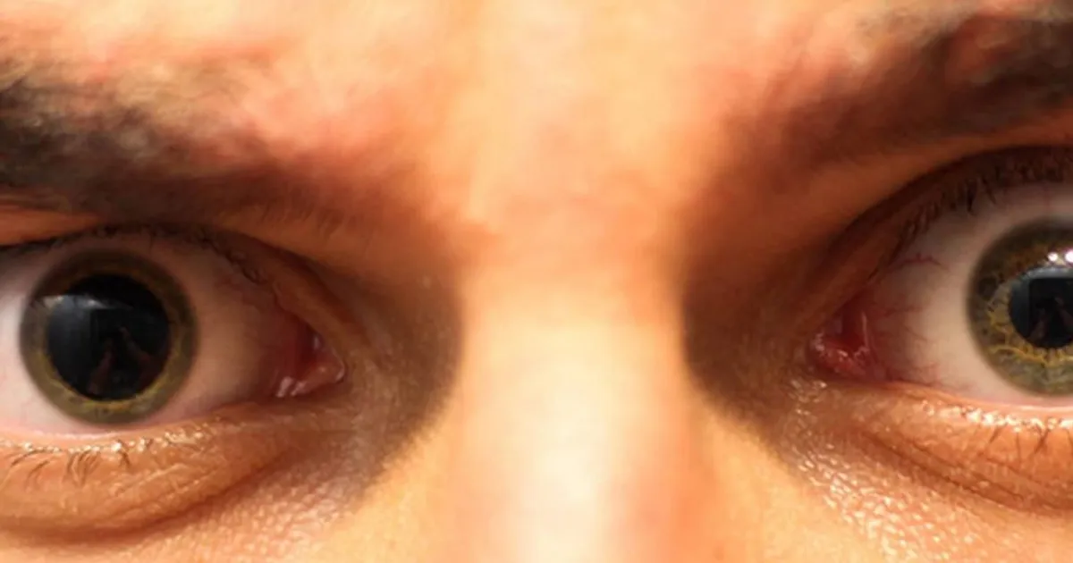 Why Am I Having My Eyes Dilated?