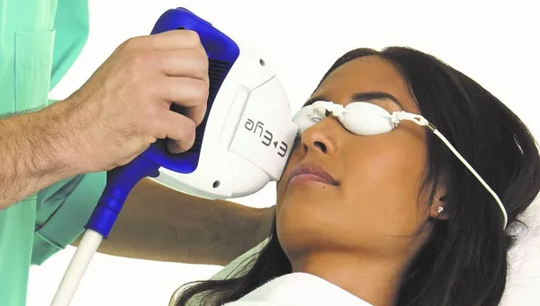 IPL Treatment for Dry Eye – Ditch The Drops!