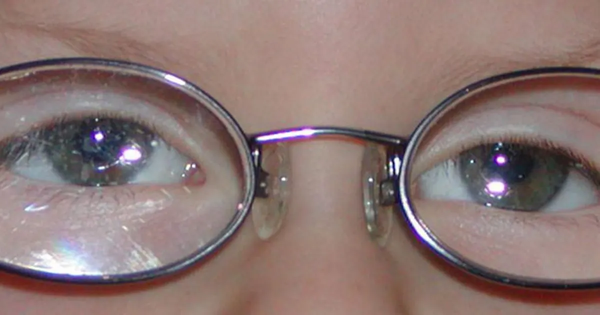 What Is Hyperopia?