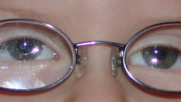 What Is Hyperopia?