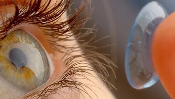 Can I Wear Contact Lenses?