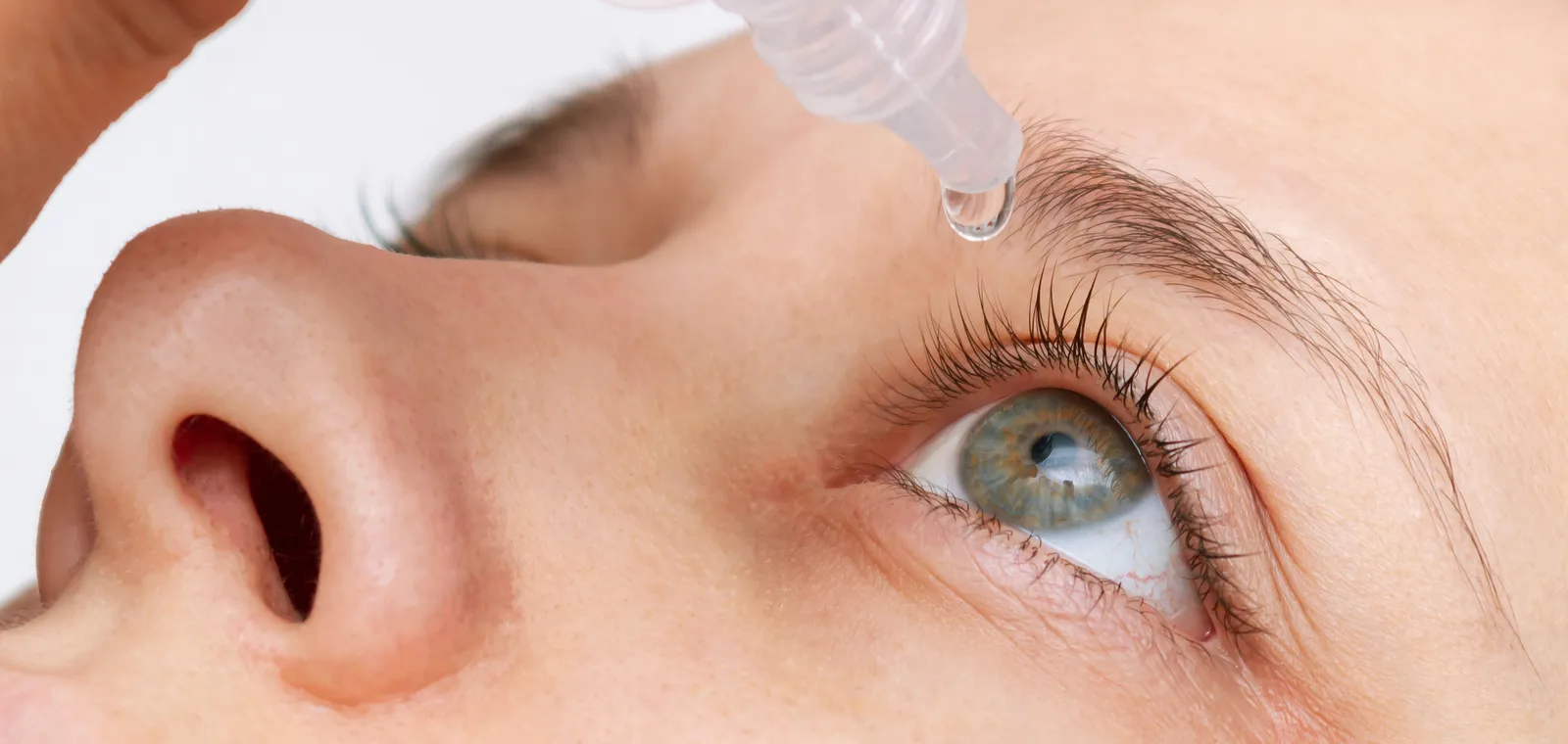A close-up of an eye with an eye-drop treatment being applied