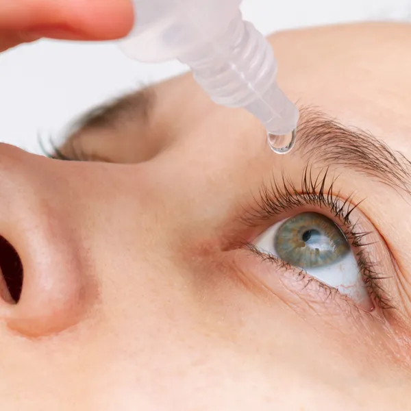 A close-up of an eye with an eye-drop treatment being applied