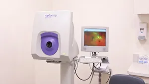 The optomap retinal scanner at Outlook Eye Centre, with a retinal image on its monitor